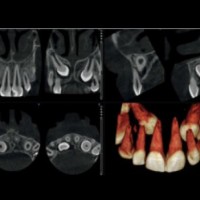 Obrázok : Zubné RTG pracovisko - DENTINIKA